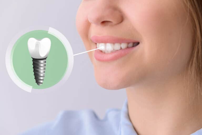 Dental Implants Plano TX Dr. Larry Tam Dr. Thanh Chiem. Custerpoint Dental General, Cosmetic, Restorative, Invisalign, Implants, Dentistry Dentist in Plano, TX 75075